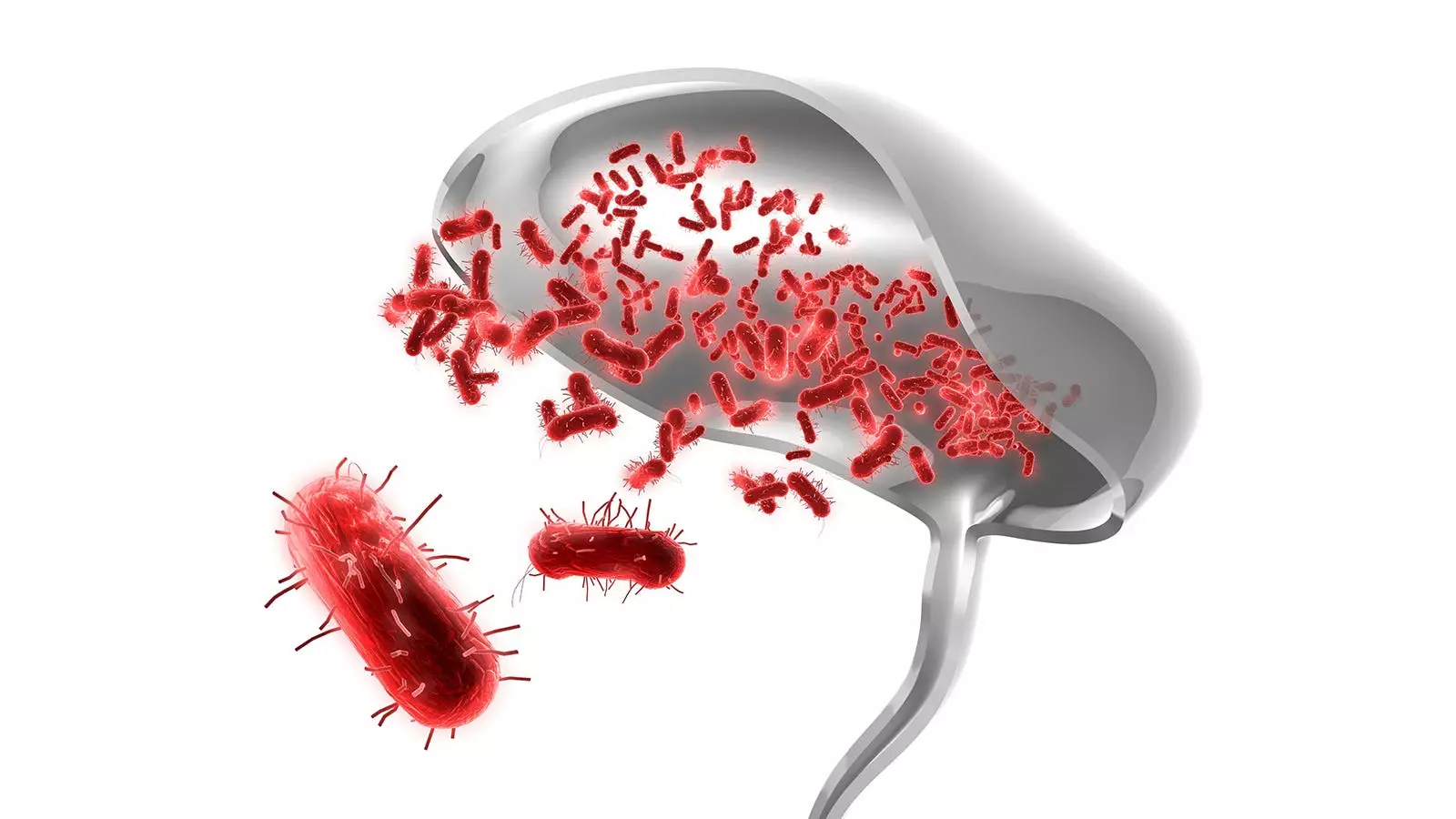 Analyze and Explore: Short-Term vs Long-Term Oral Antibiotic Treatment for Febrile UTIs in Kids