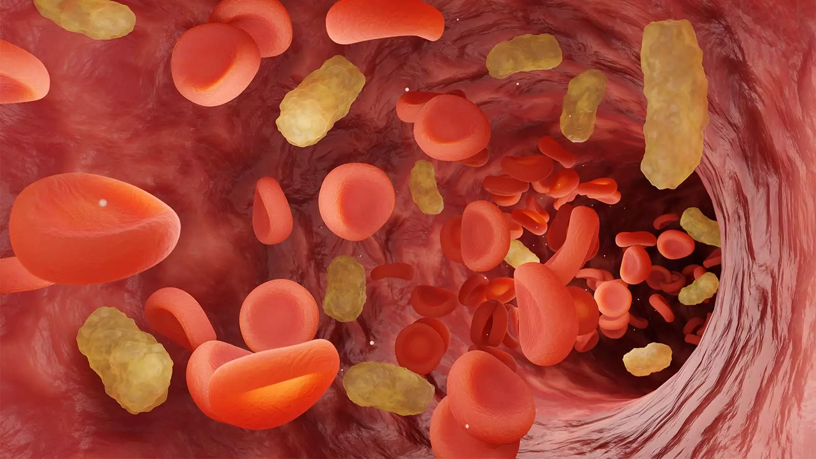 Improving the Transition from IV to Oral Antibiotics in Gram-Negative Bloodstream Infections