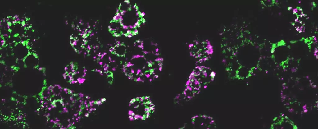 The Link Between Obesity and Fragmented Mitochondria: Implications for Weight Gain and Metabolic Dysfunctions