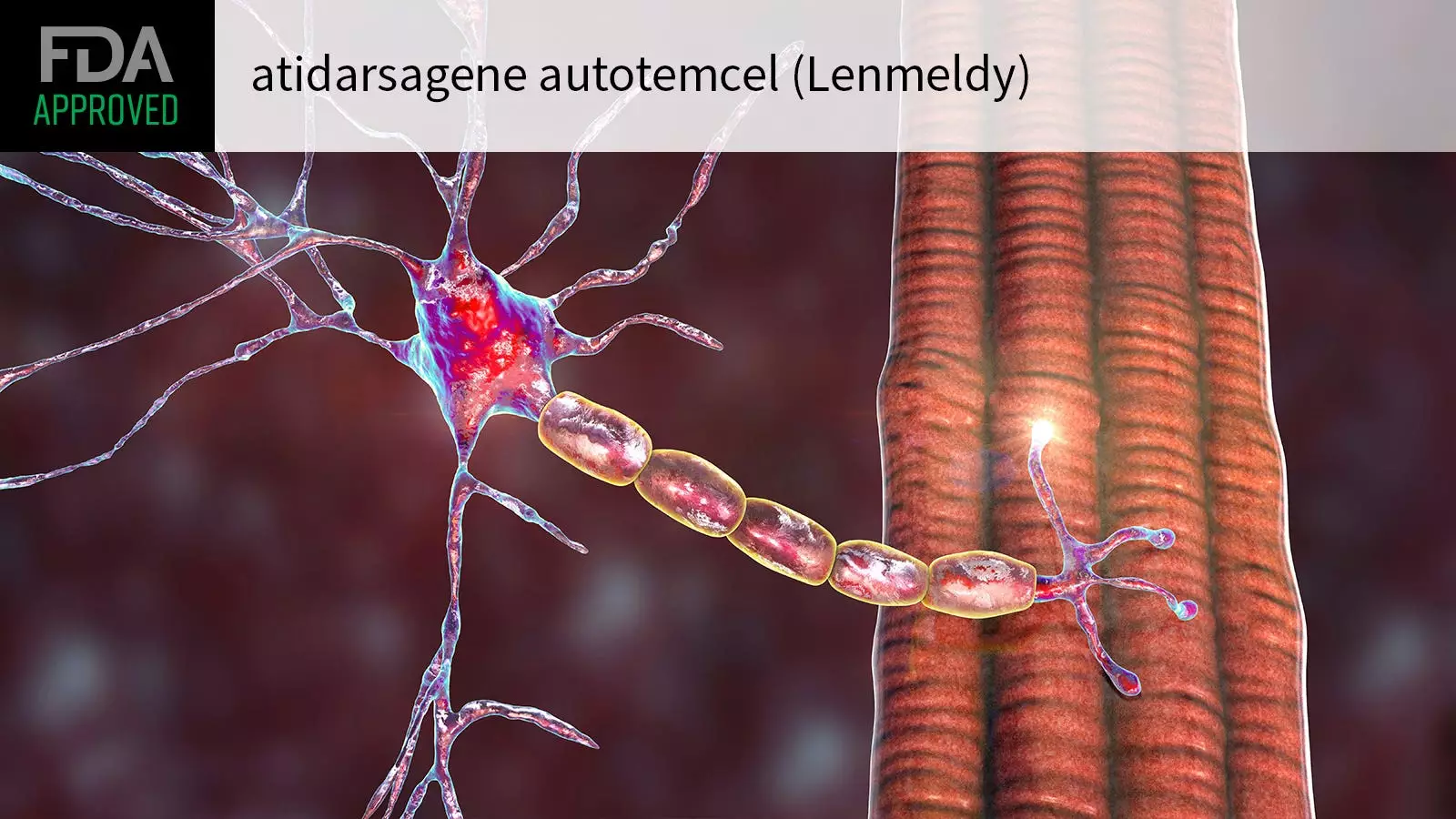 The FDA Approves First Gene Therapy for Children with Metachromatic Leukodystrophy