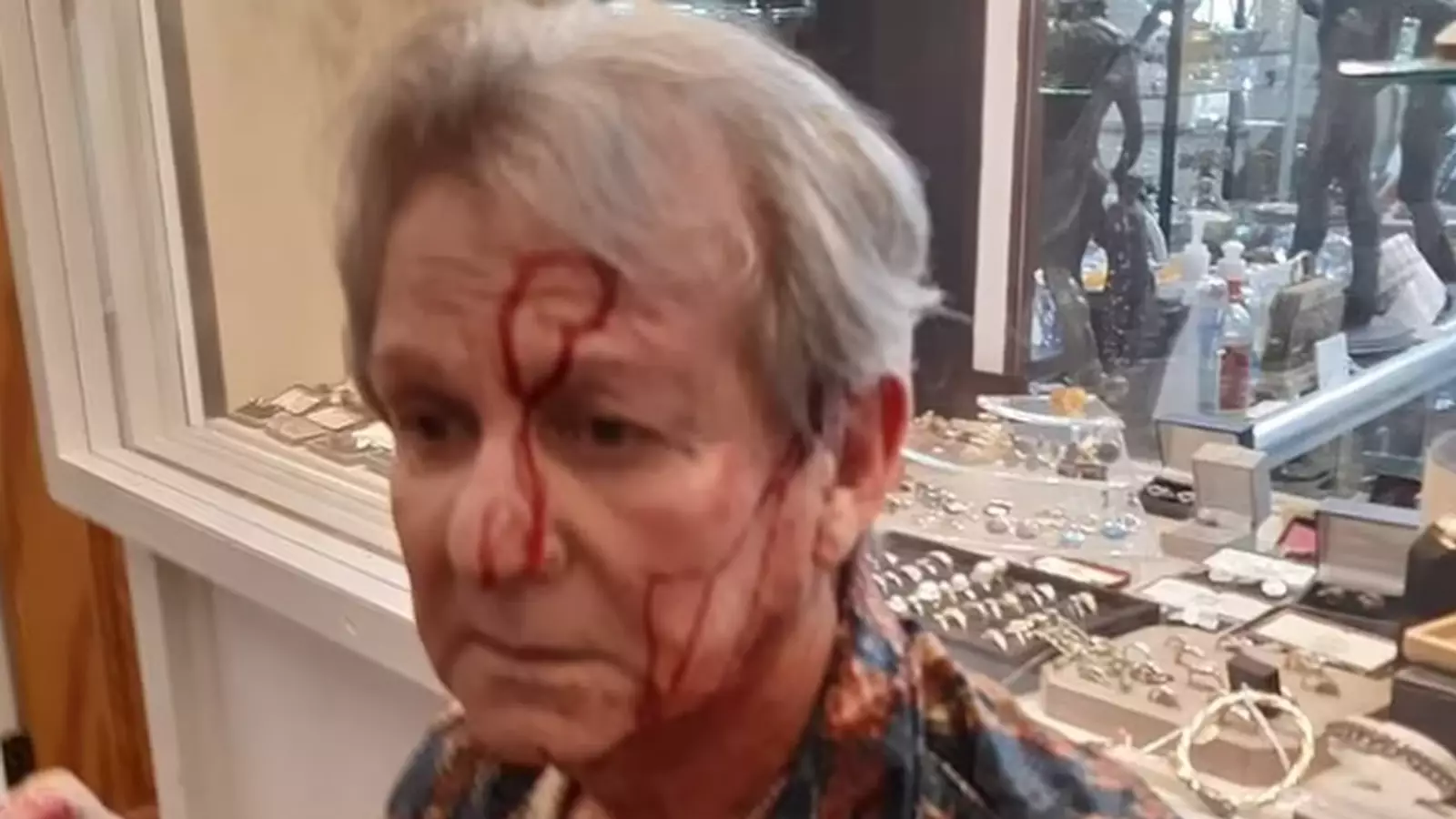 The Aftermath of a Violent Attack on a Celebrity Antiques Expert