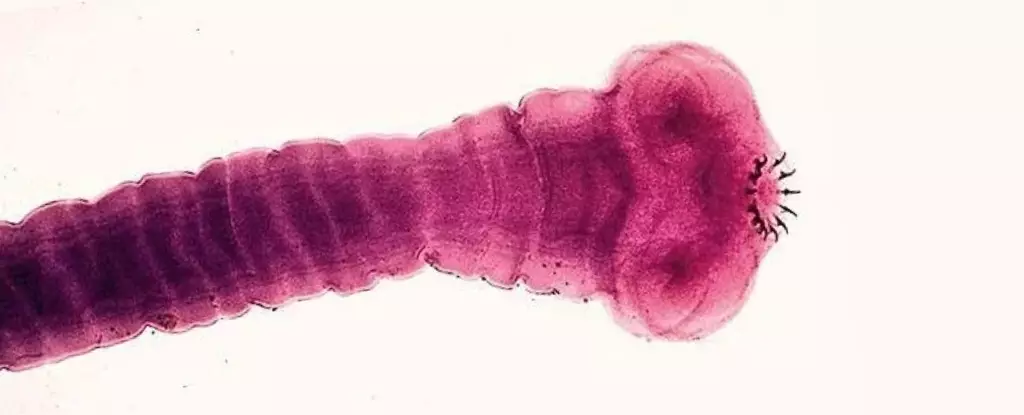 Cases of Neurocysticercosis on the Rise: A Unique Case Study