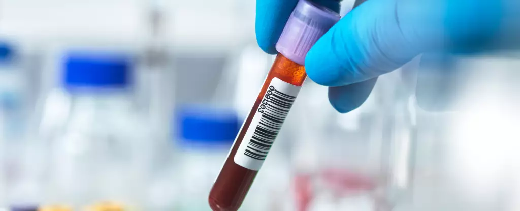 The Potential for Early Alzheimer’s Detection through a Simple Blood Test