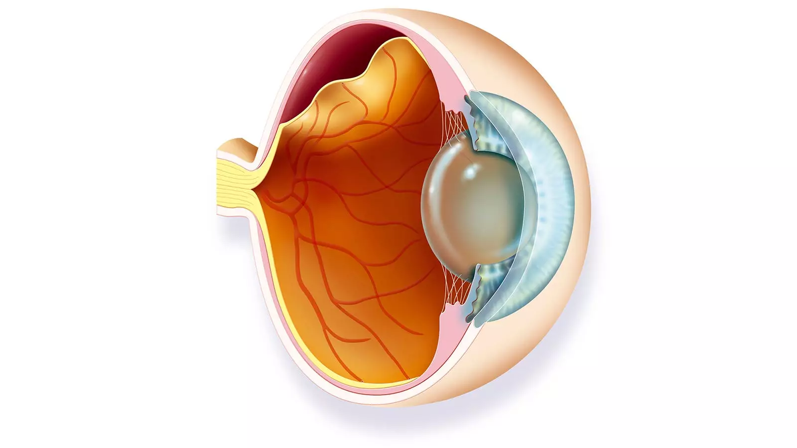 Understanding the Impact of Social Determinants on Retinal Detachment