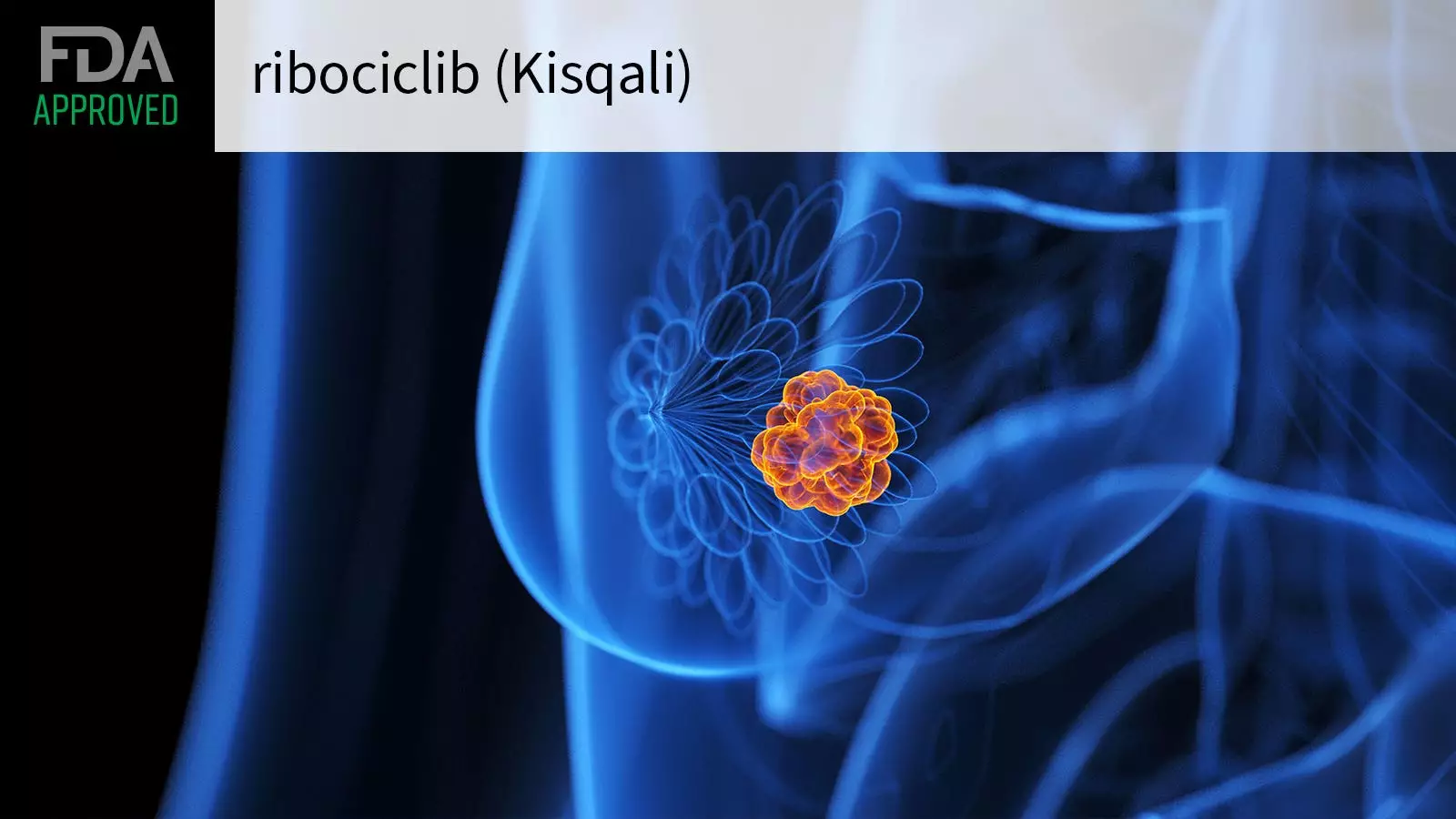 FDA Approves Ribociclib for Early High-Risk Breast Cancer: A New Era in Adjuvant Therapy