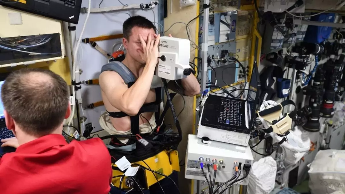 Vision Impairment Challenges for Astronauts: Insights into Spaceflight-Associated Neuro-Ocular Syndrome