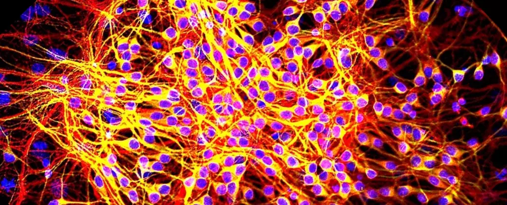 Transformative Sleep Drug: A Ray of Hope Against Neurodegeneration