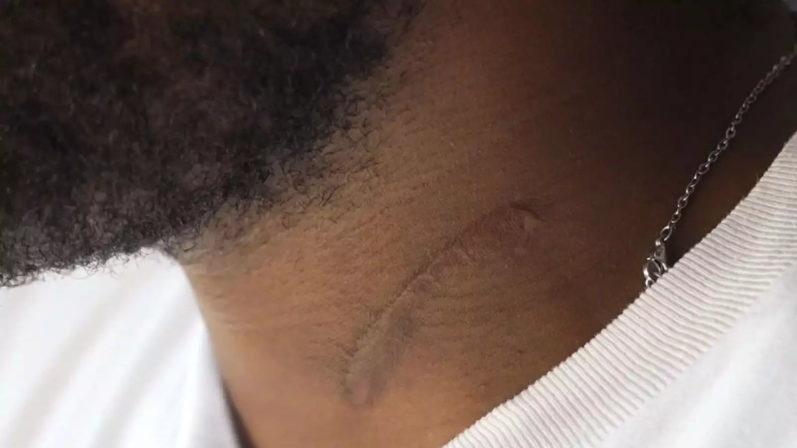 Trauma and Triumph: The Dark Aftermath of the Hainault Samurai Sword Attack