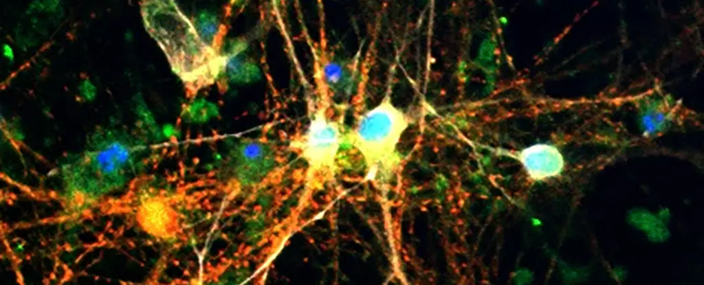 The Hidden Power of Brain Glycogen: A Game Changer in Neurodegenerative Disease